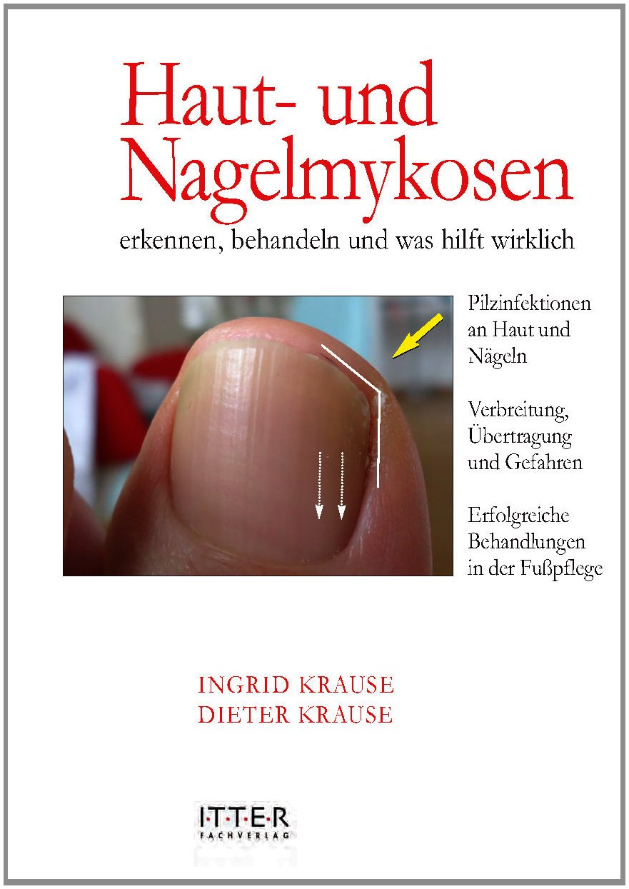 Haut- und Nagelmykosen erkennen, behandeln und was hilft wirklich Leisure, Home & Garden