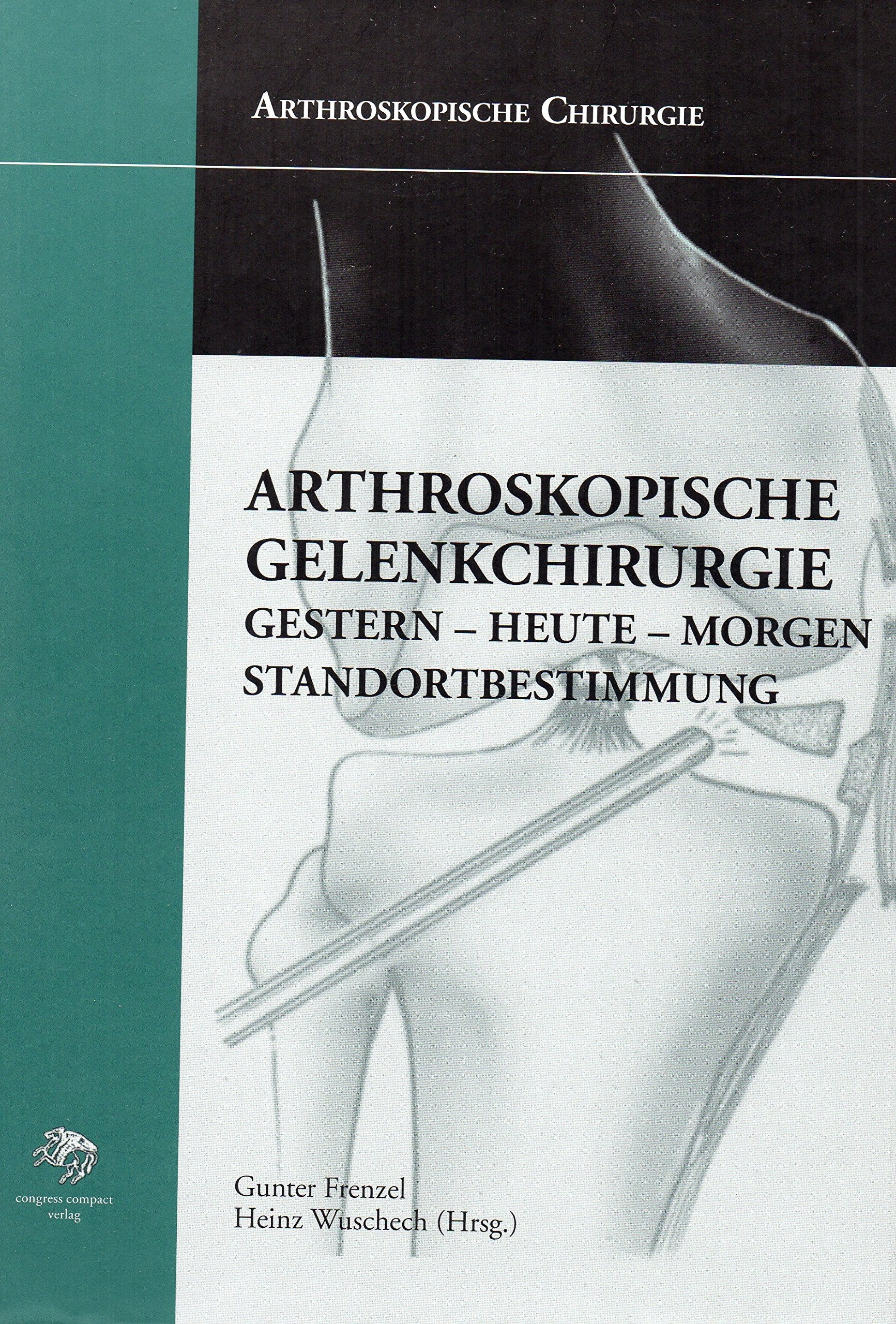 Arthroskopische Chirurgie: Arthroskopische Gelenkchirurgie. Gestern - Heute - Morgen. Standortbestimmung Books