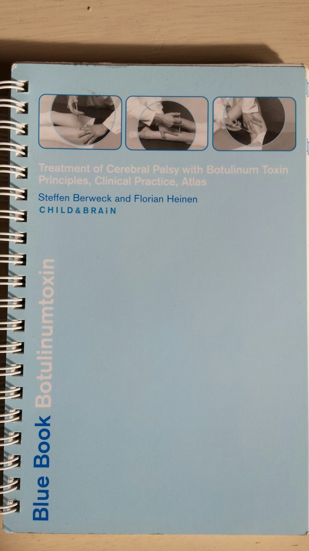 Blue Book Botulinumtoxin - Treatment of Cerebral Palsy with Botulinum Toxin - Principles, Clinical Practice, Atlas book