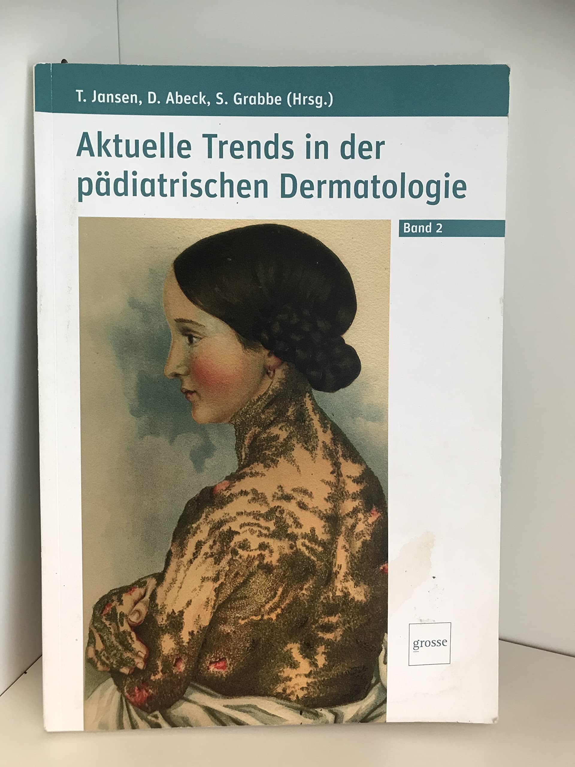 Aktuelle Trends in der pädiatrischen Dermatologie 2 Medicine