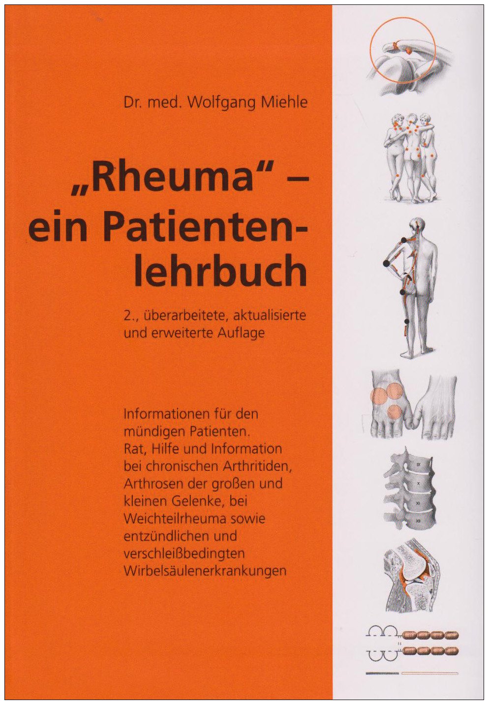 Rheuma - Ein Patienten-Lehrbuch book