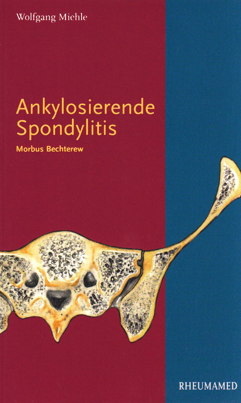 Ankylosierende Spondylitis: Morbus Bechterew Medicine