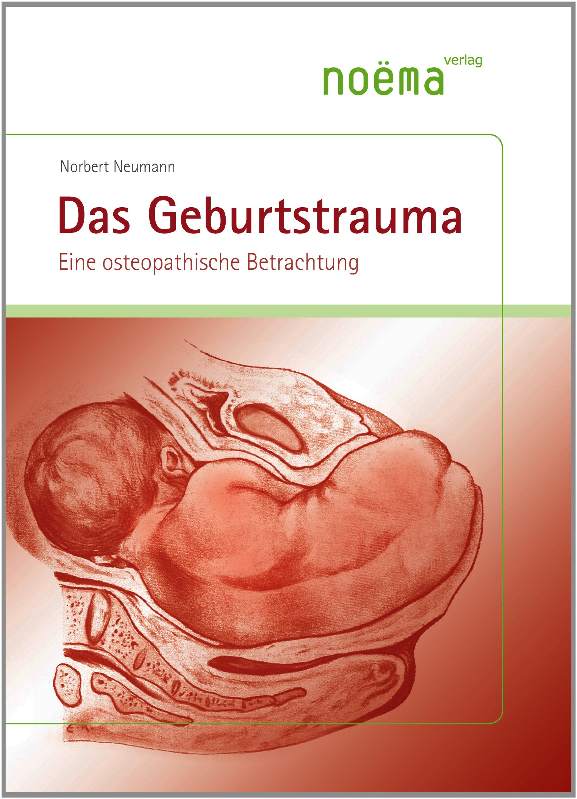 Das Geburtstrauma: Eine osteopathische Betrachtung Medicine