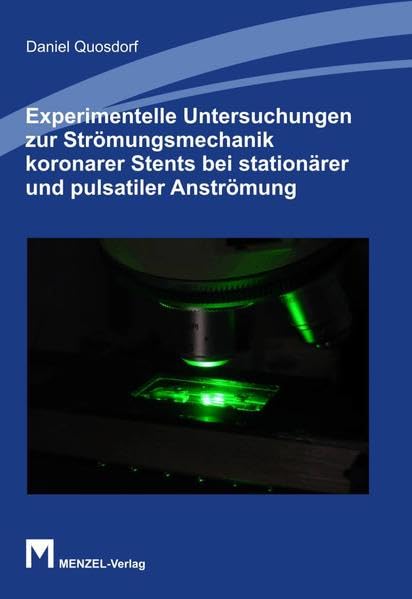 Experimentelle Untersuchungen zur Strömungsmechanik koronarer Stents bei stationärer und pulsatiler Anströmung Leisure, Home & Garden