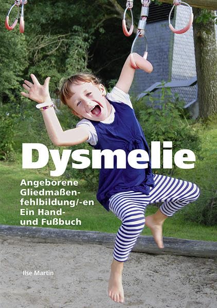 Dysmelie Angeborene Gliedmaßenfehlbildung/-en: Ein Hand- und Fußbuch Medicine