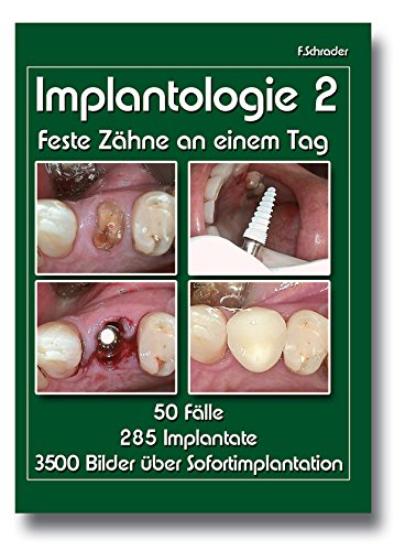Implantologie 2 Books