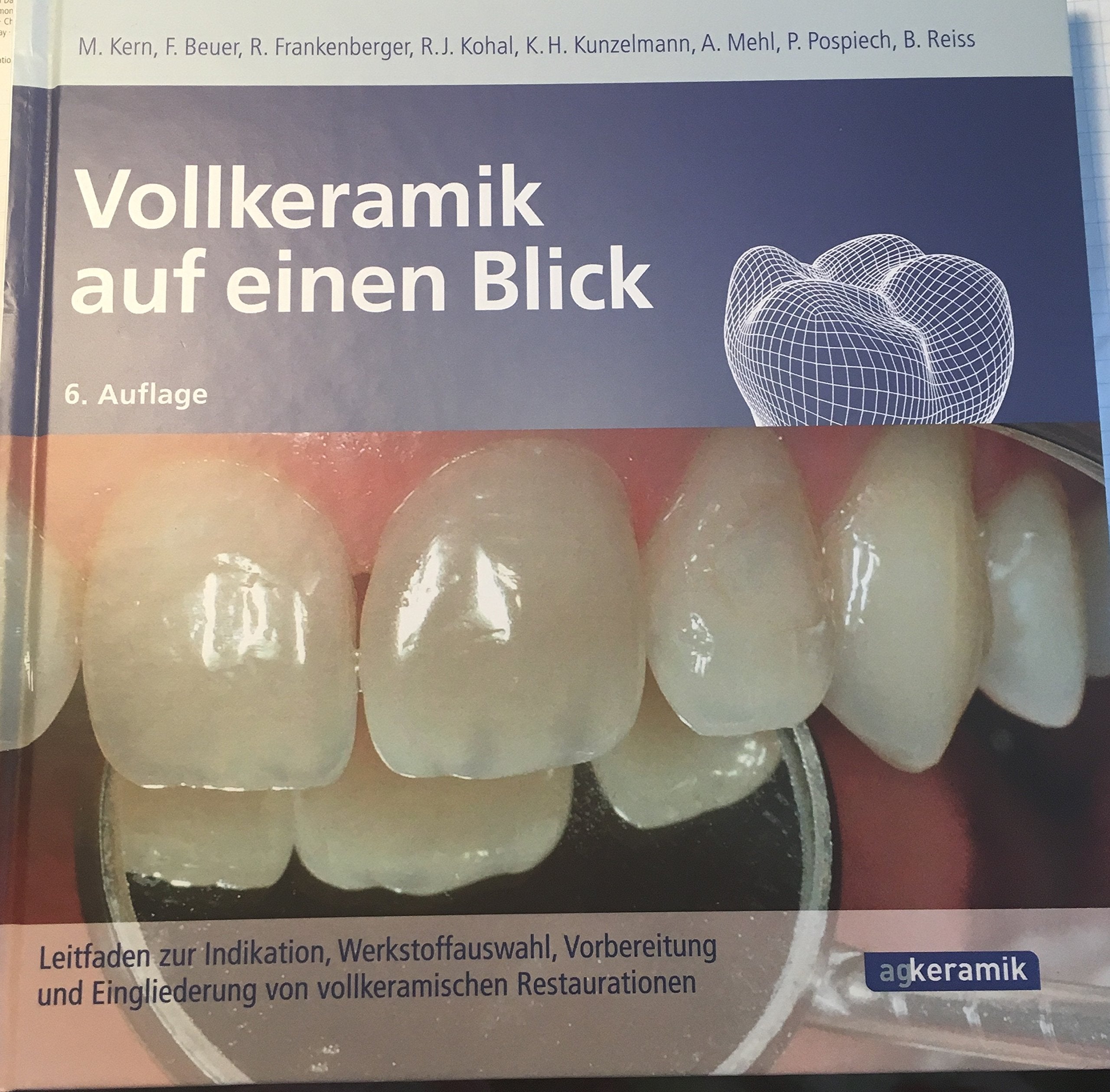 Vollkeramik auf einen Blick: 6. Auflage. überarbeitet 2018 Deutsch. Leitfaden zur Indikation Medicine