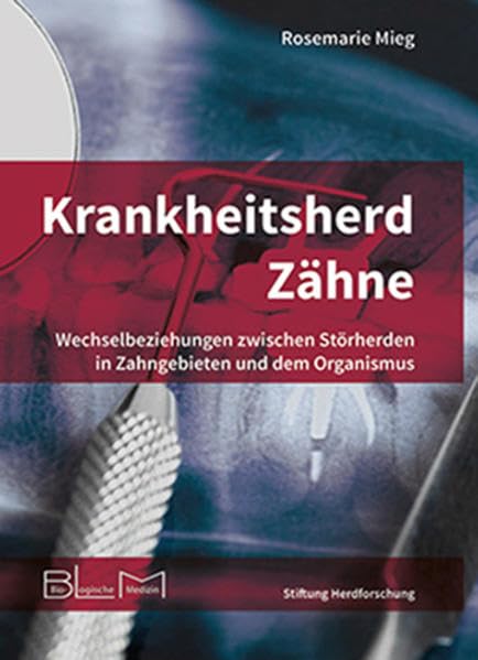 Krankheitsherd Zähne: Wechselbeziehungen zwischen Störherden in Zahngebieten und dem Organismus Medicine