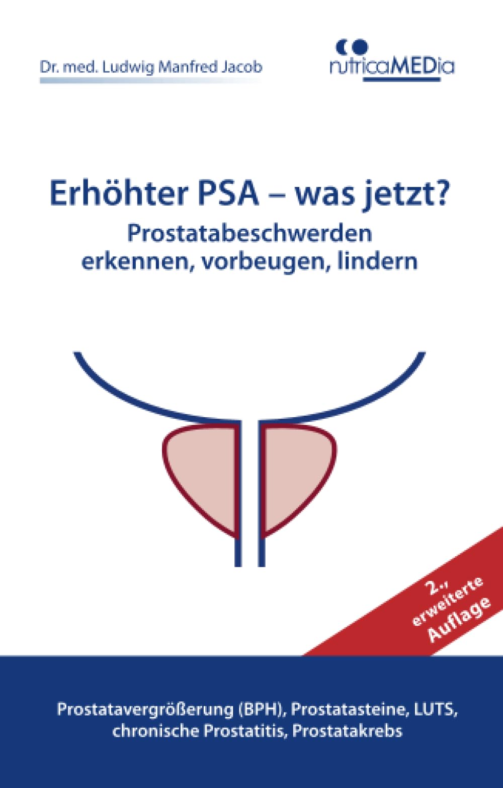 Erhöhter PSA – was jetzt? Prostatabeschwerden erkennen, vorbeugen, lindern, 2., erweiterte Auflage: Prostatavergrößerung (BPH), Prostatasteine, LUTS, chronische Prostatitis, Prostatakrebs Health, Nutrition & Fitness