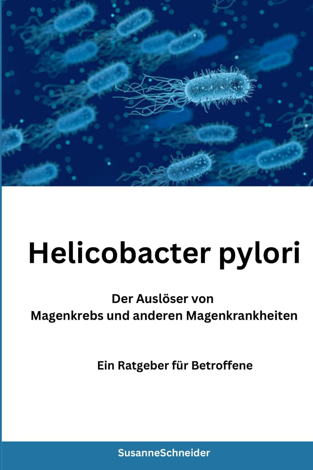 Helicobacter pylori - Der Auslöser von Magenkrebs und anderen Magenkrankheiten Medicine