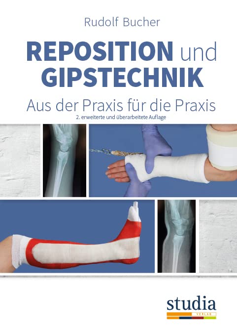 Reposition und Gipstechnik II: Aus der Praxis für die Praxis Medicine