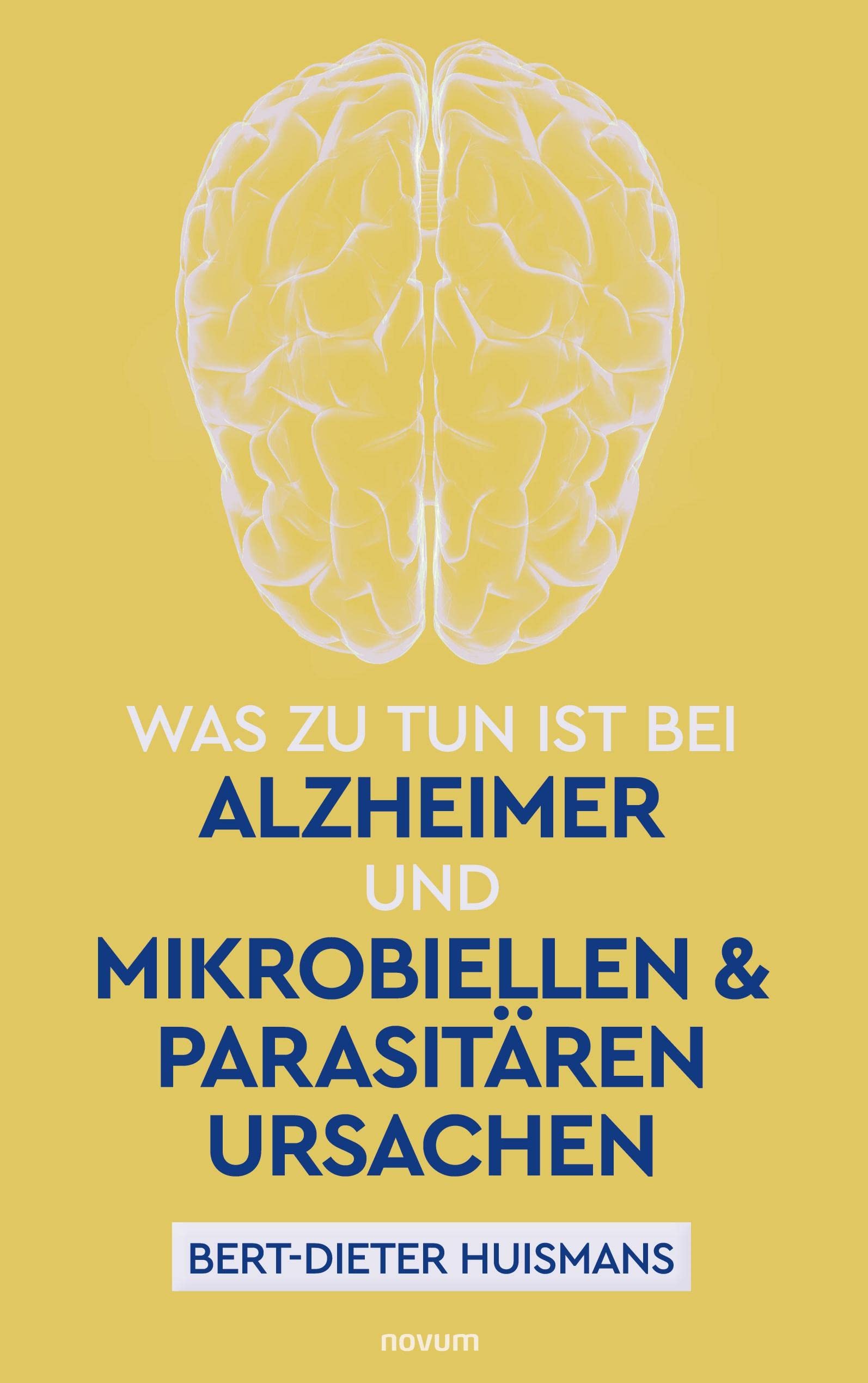 Was zu tun ist bei Alzheimer und mikrobiellen & parasitären Ursachen Contemporary literature