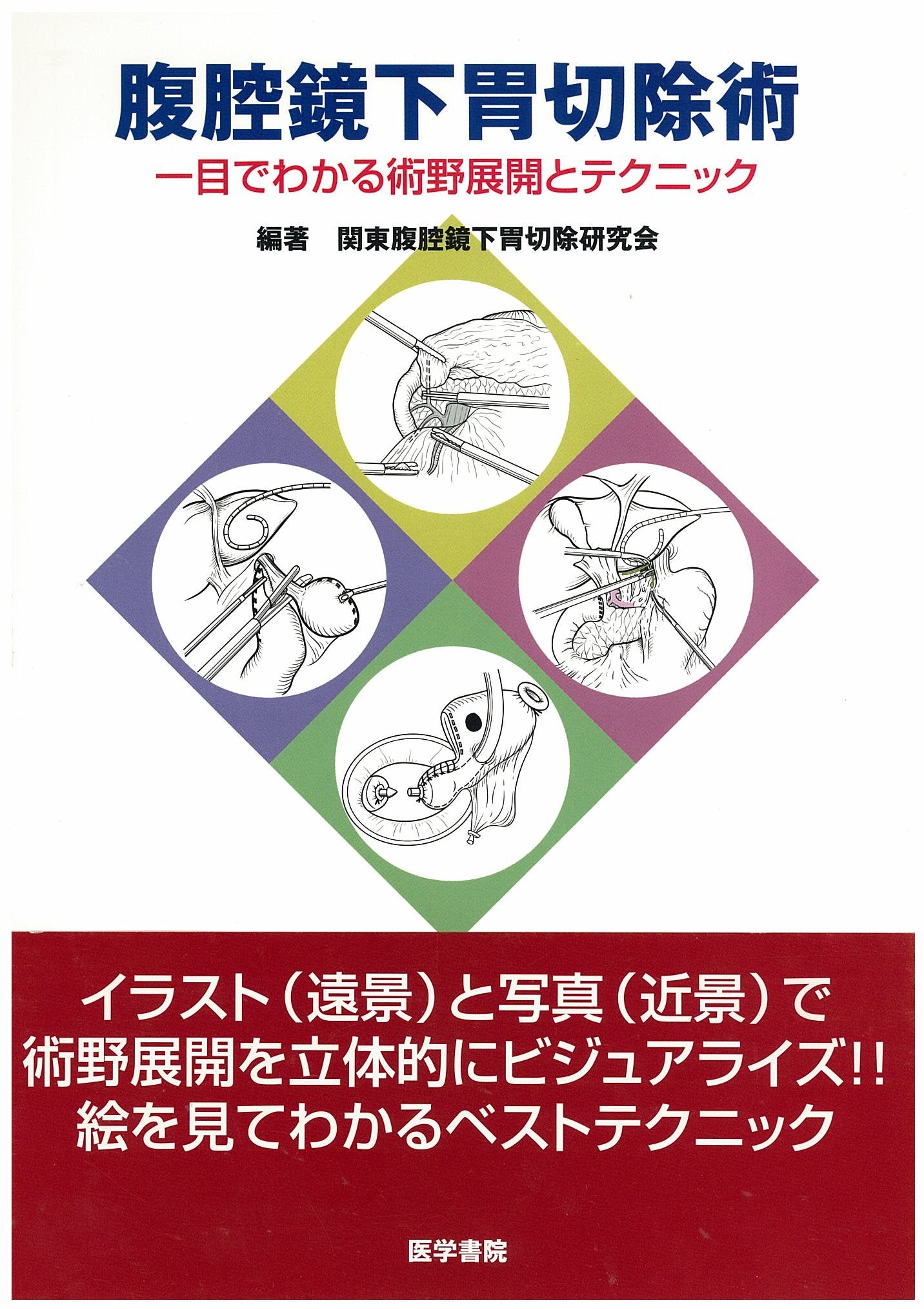 腹腔鏡下胃切除術―一目でわかる術野展開とテクニック Books