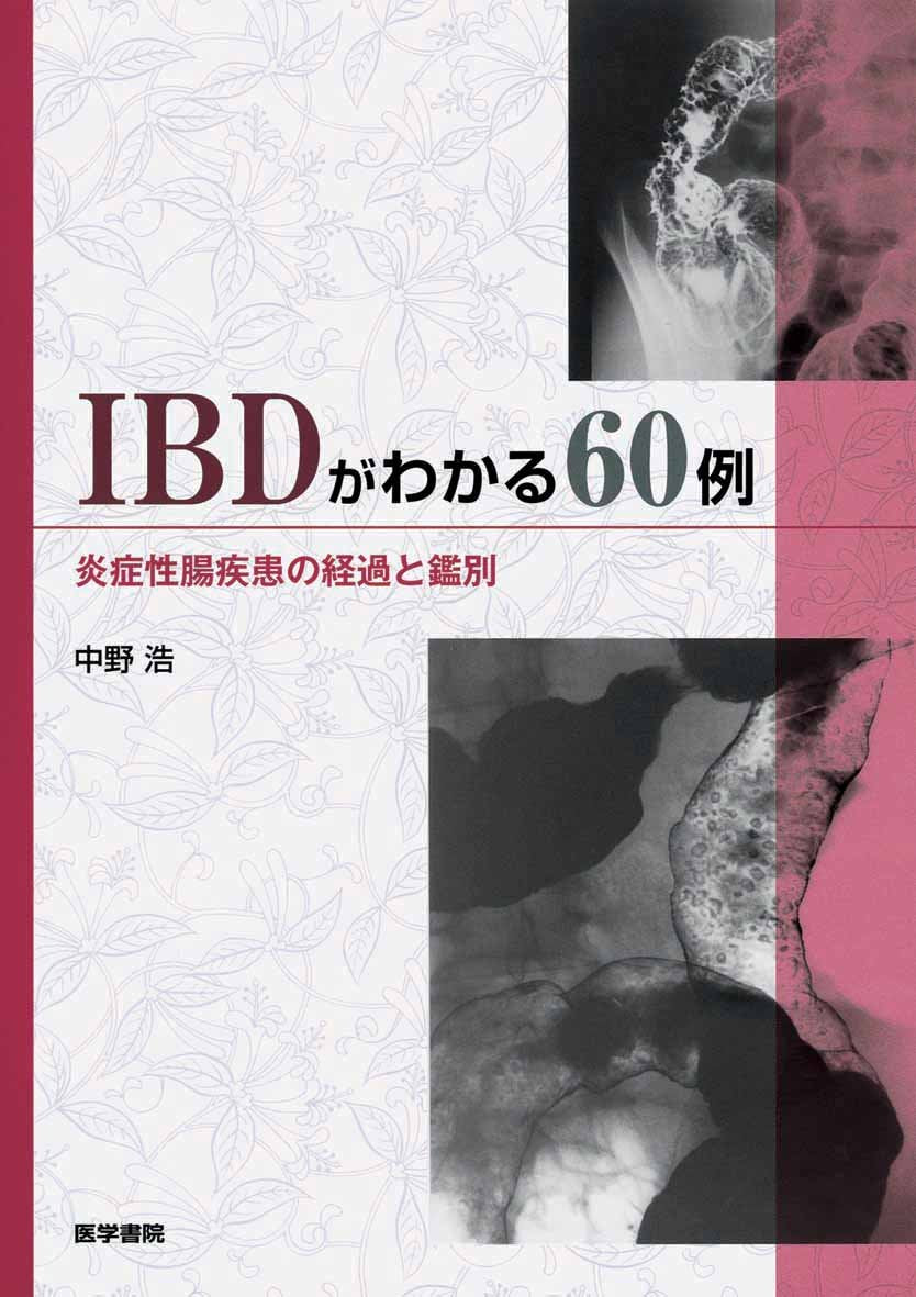 IBD ga wakaru 60rei : EnshoÌ„sei choÌ„ shikkan no keika to kanbetsu book