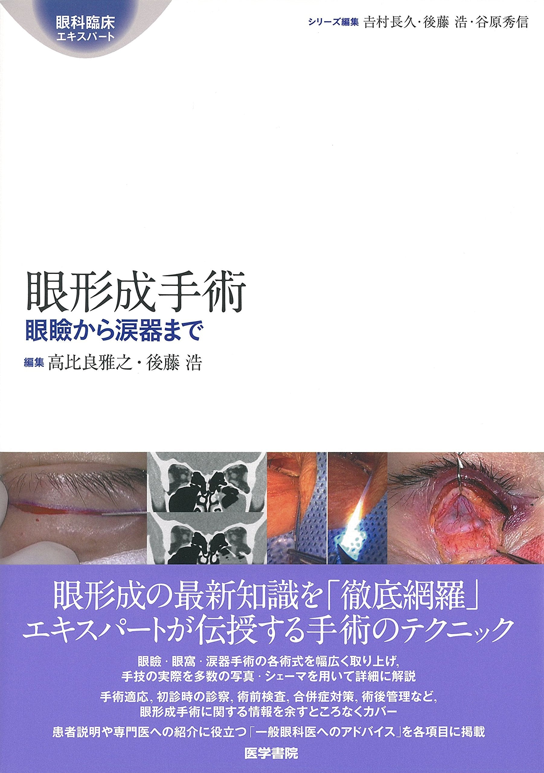 眼形成手術: 眼瞼から涙器まで (眼科臨床エキスパート) Books