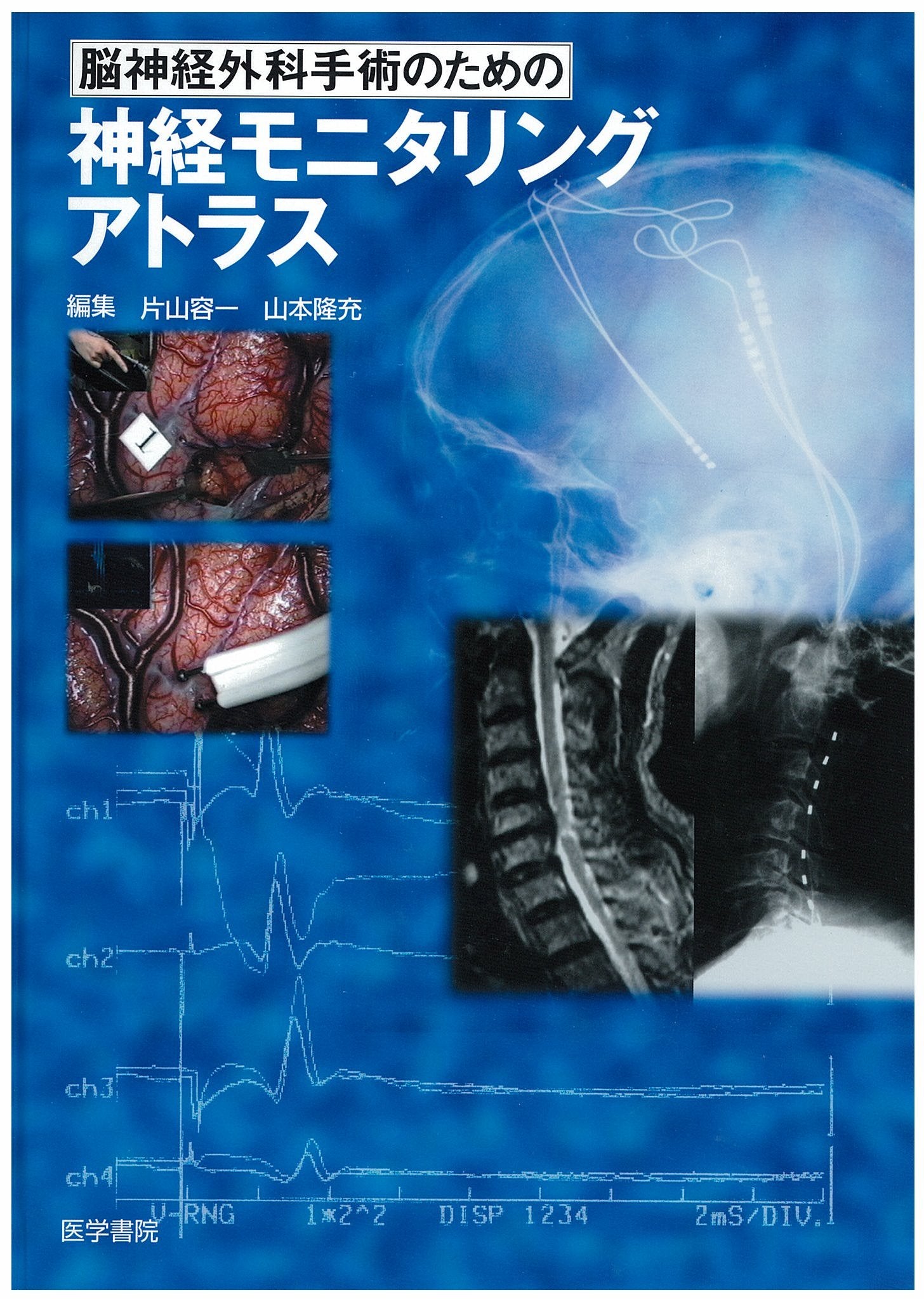 è„³ç¥žçµŒå¤–ç§‘æ‰‹è¡“ã®ãŸã‚ã®ç¥žçµŒãƒ¢ãƒ‹ã‚¿ãƒªãƒ³ã‚°ã‚¢ãƒˆãƒ©ã‚¹ Books