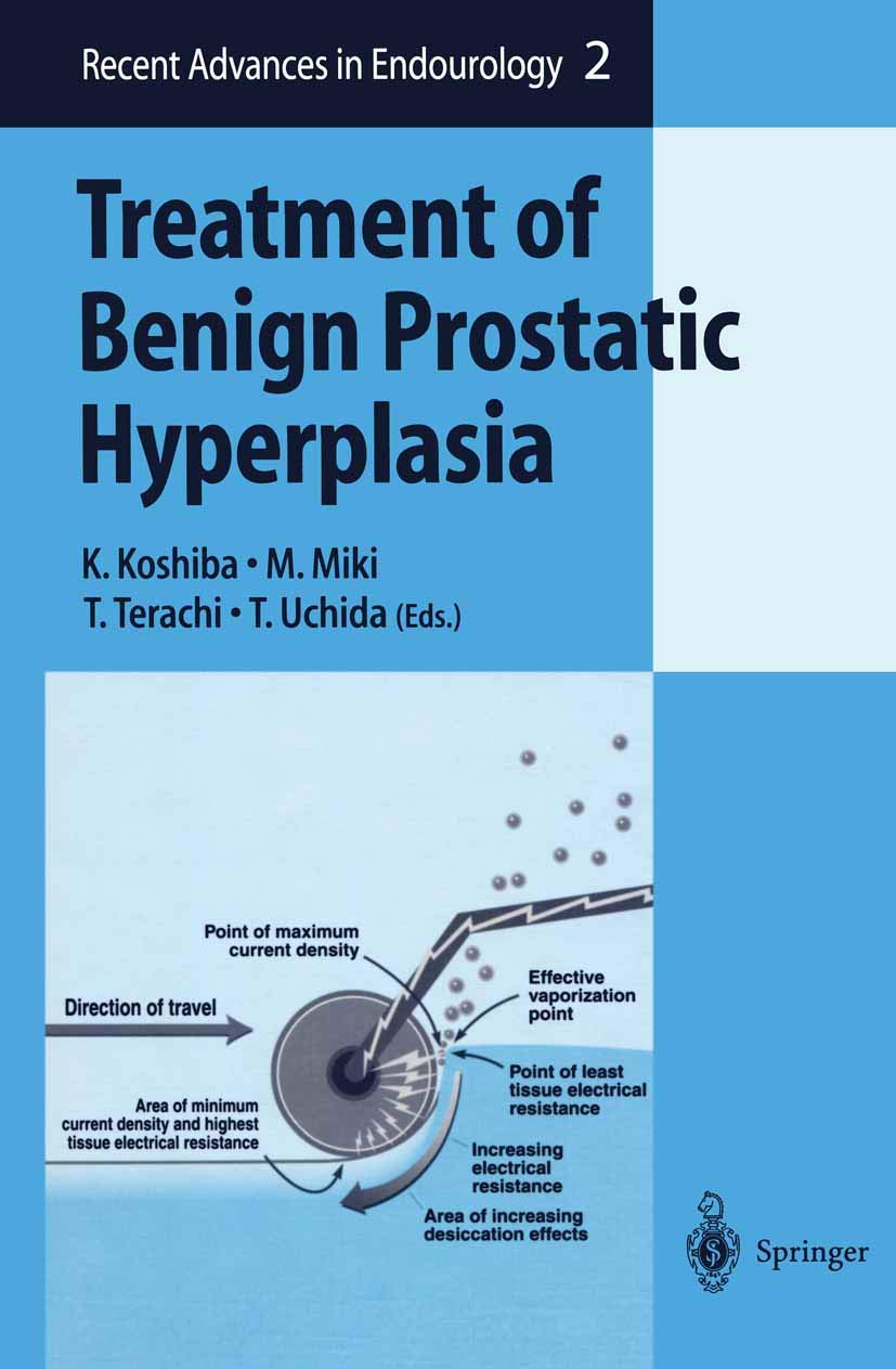 Treatment of Benign Prostatic Hyperplasia (Recent Advances in Endourology, 2, Band 2) Medicine