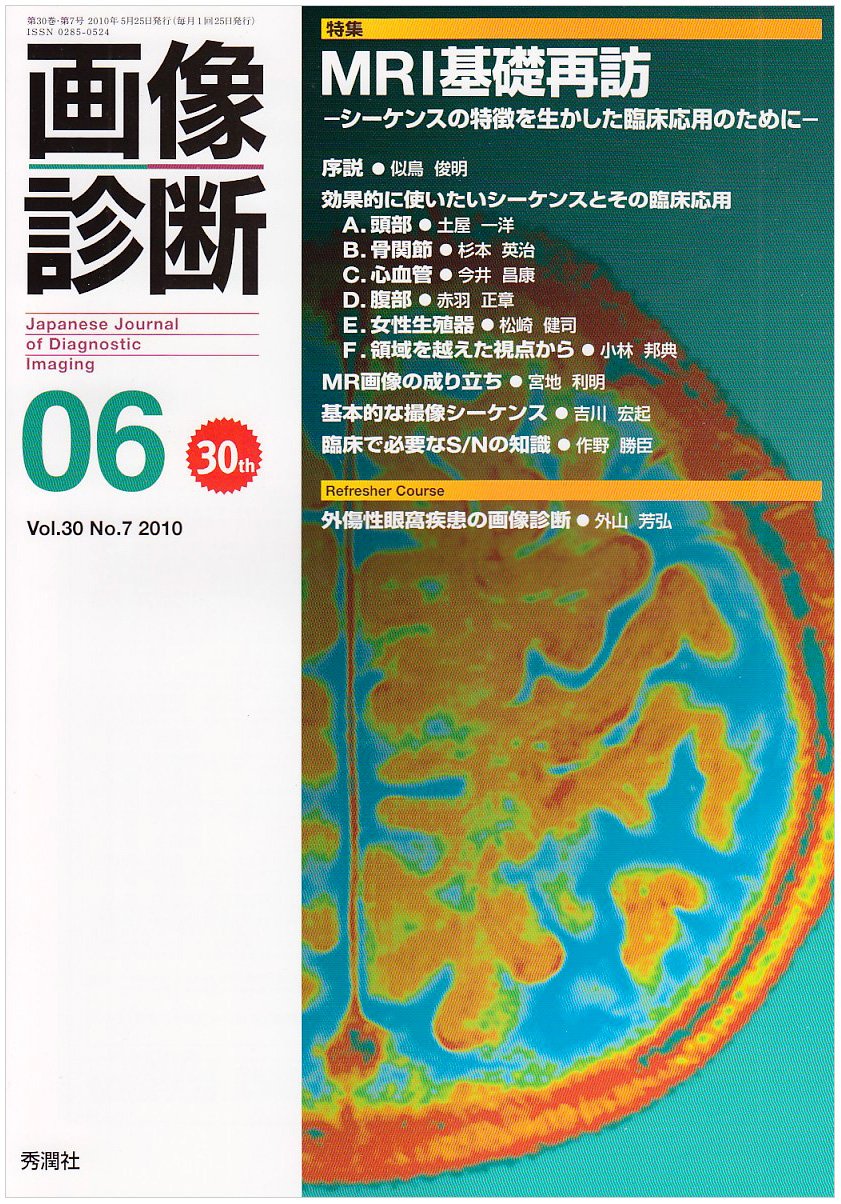 画像診断 10年6月号 30ー7 特集:MRI基礎再訪 Books