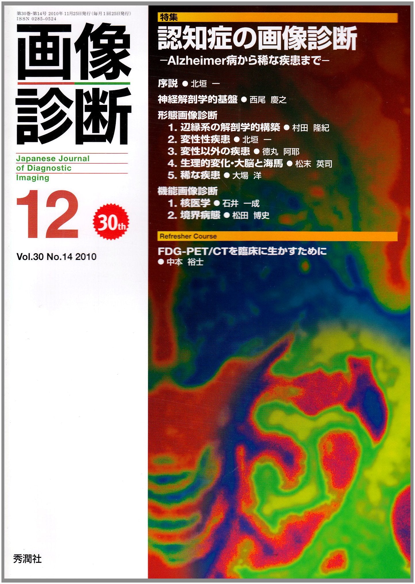 画像診断 10年12月号 30ー14 特集:認知症の画像診断 Books