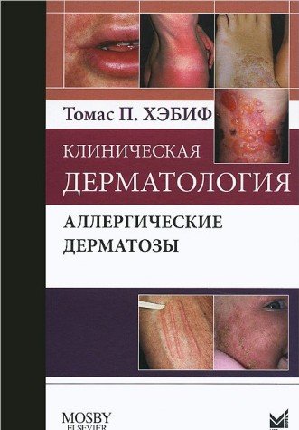Klinicheskaya dermatologiya. Allergicheskie dermatozy Books