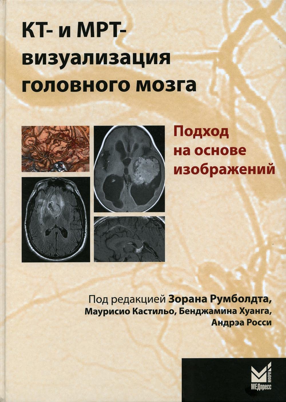 КТ- и МРТ- визуализация головного мозга. Подход на основе изображений. 2-е изд Books