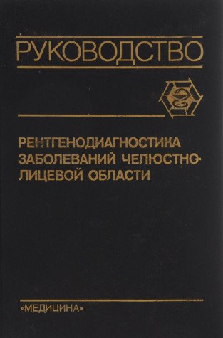 Rentgenodiagnostika zabolevaniy chelyustno-litsevoy oblasti Books