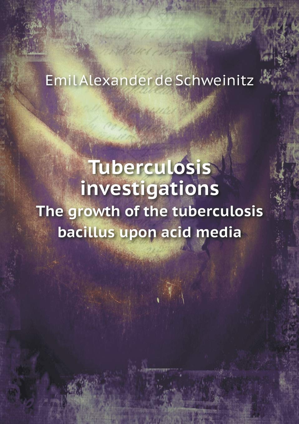 Tuberculosis investigations The growth of the tuberculosis bacillus upon acid media Books