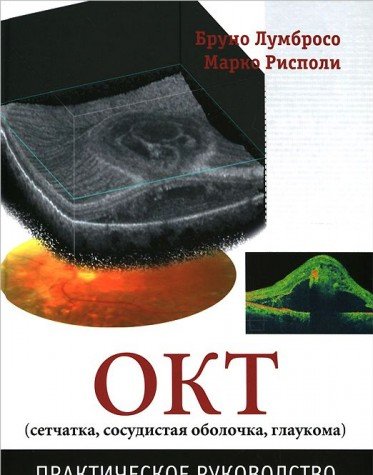 OKT (setchatka, sosudistaya obolochka, glaukoma). Prakticheskoe rukovodstvo Books