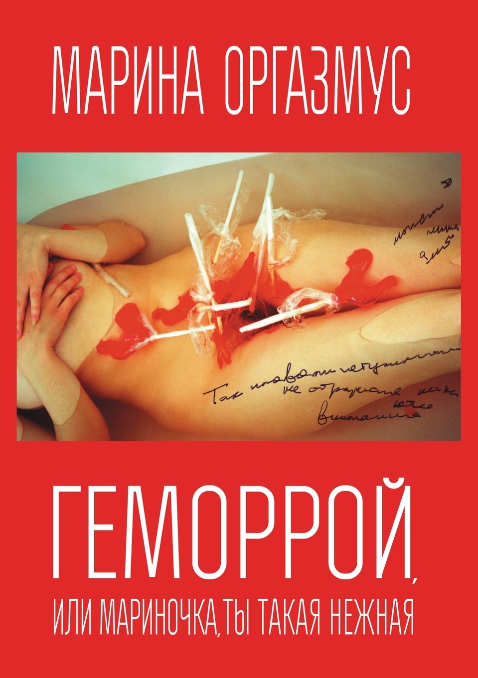 Gemorroj, ili Marinochka, ty takaya nezhnaya (Russian Edition) Books