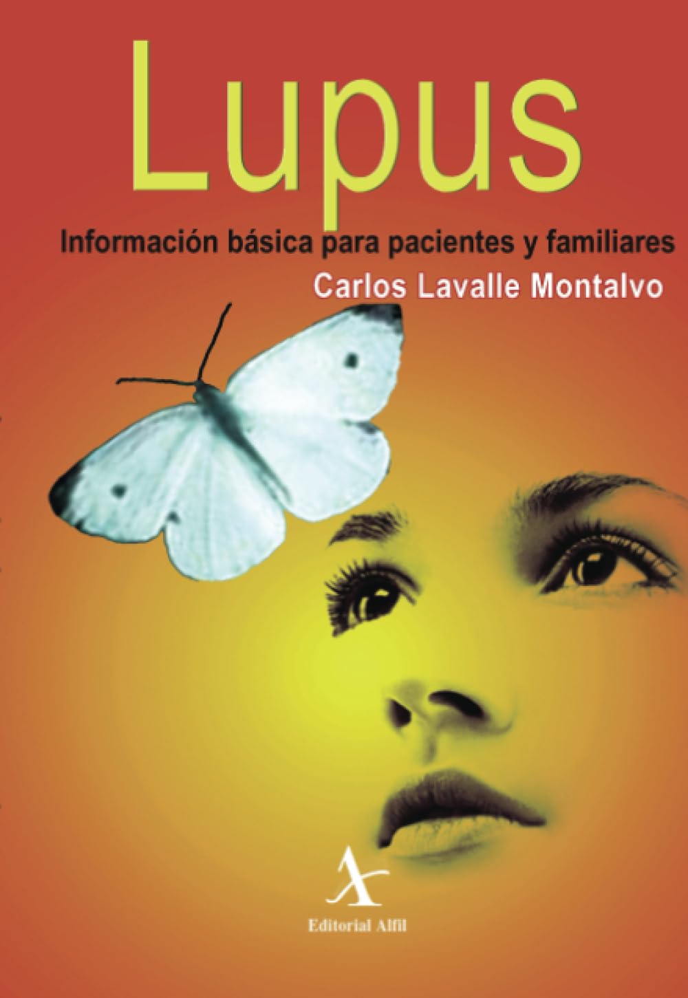 Lupus. Información básica para pacientes y familiares Medicine