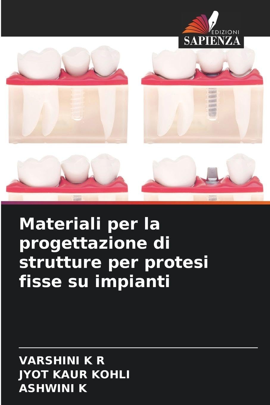 Materiali per la progettazione di strutture per protesi fisse su impianti Medicine