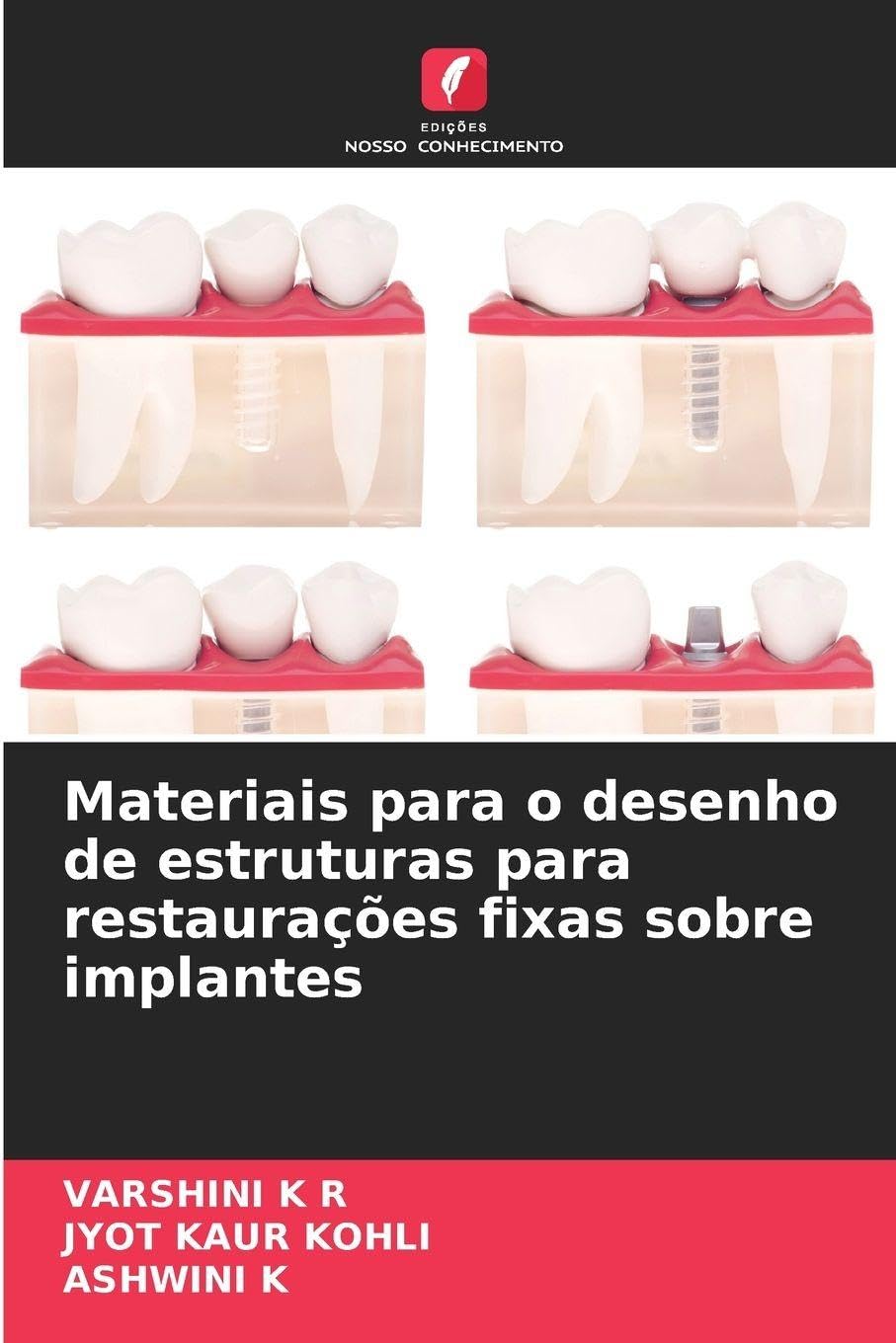 Materiais para o desenho de estruturas para restaurações fixas sobre implantes Medicine