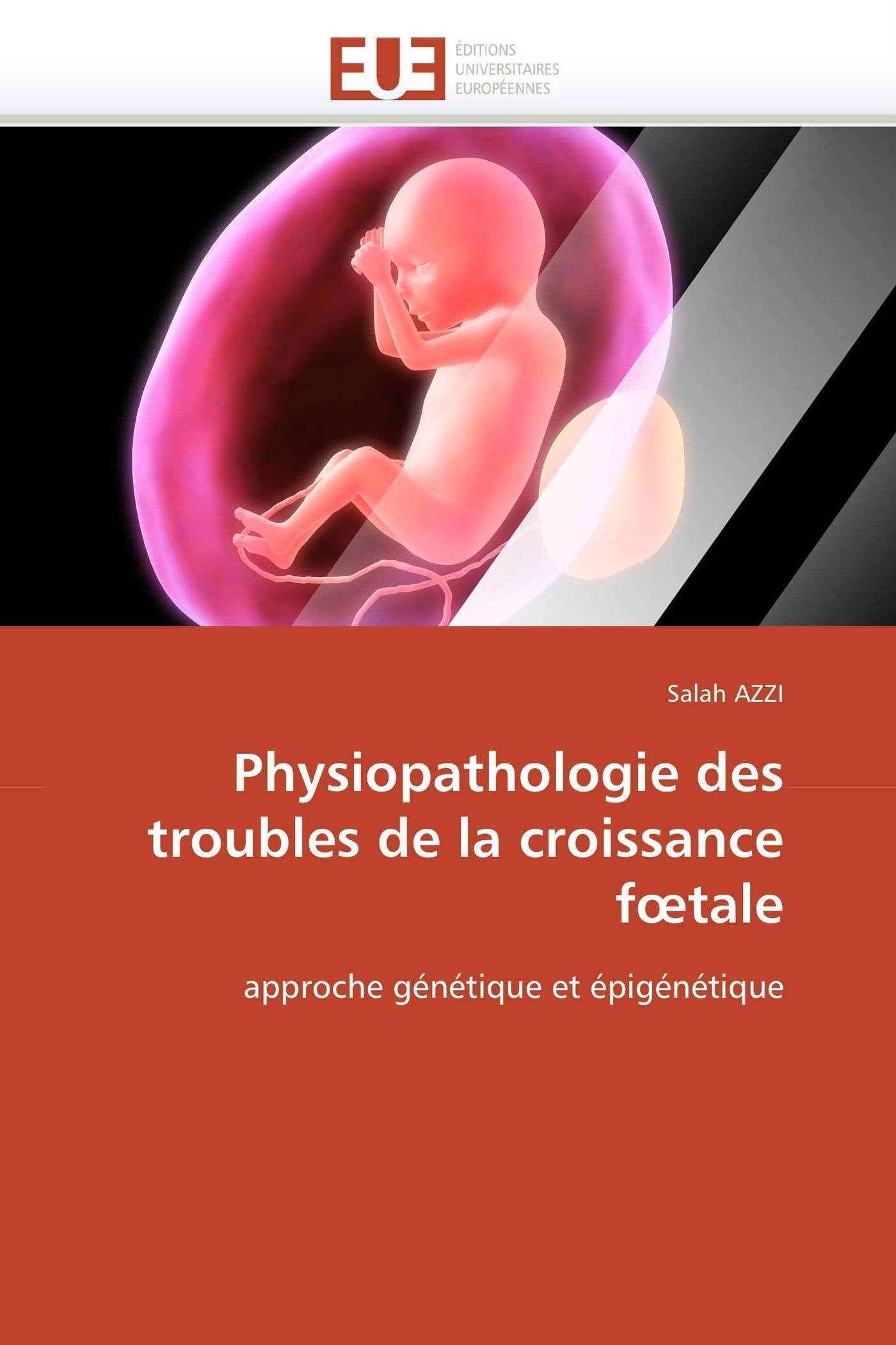 Physiopathologie des troubles de la croissance fœtale: approche génétique et épigénétique book