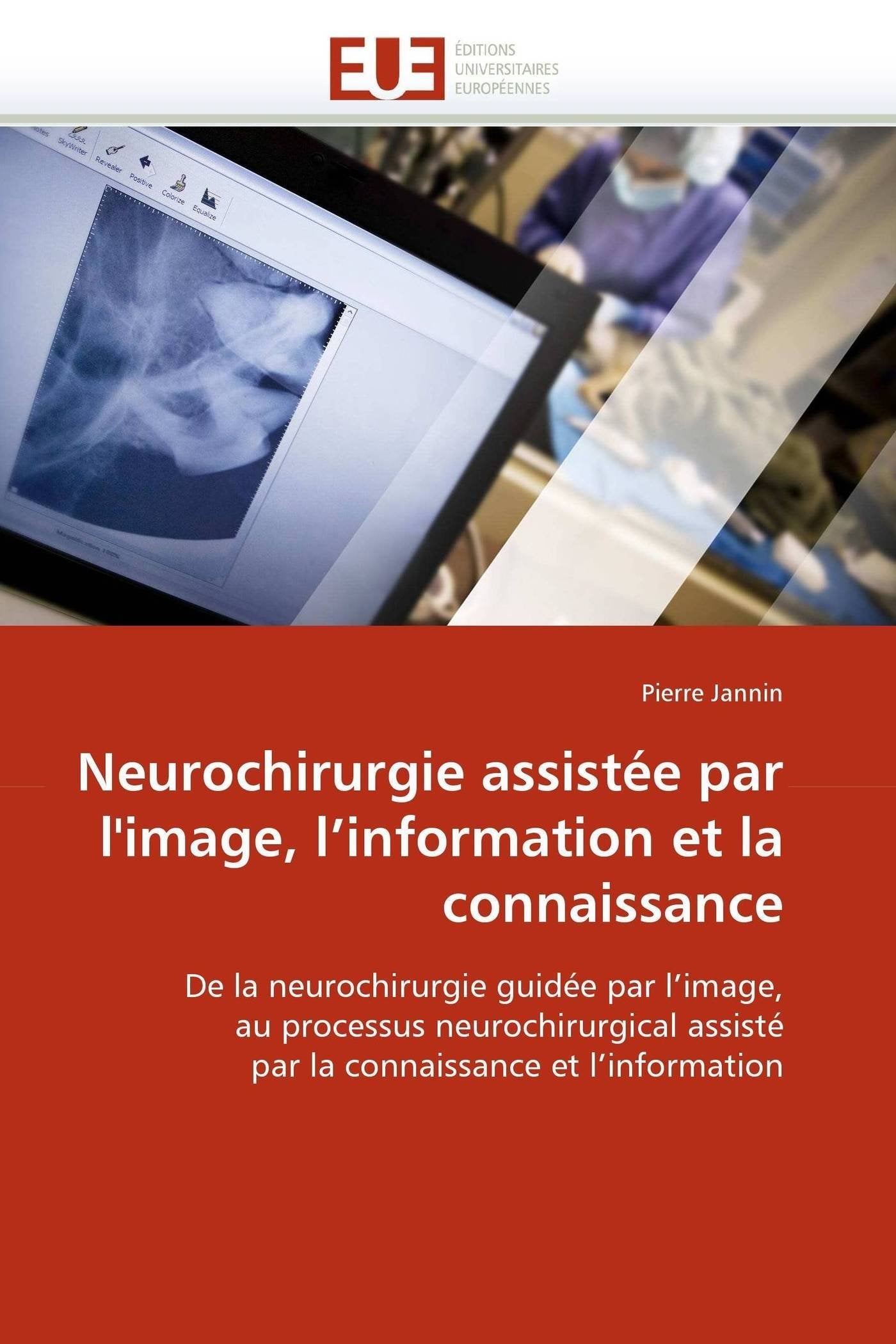 Neurochirurgie assistée par l''image, l''information et la connaissance book