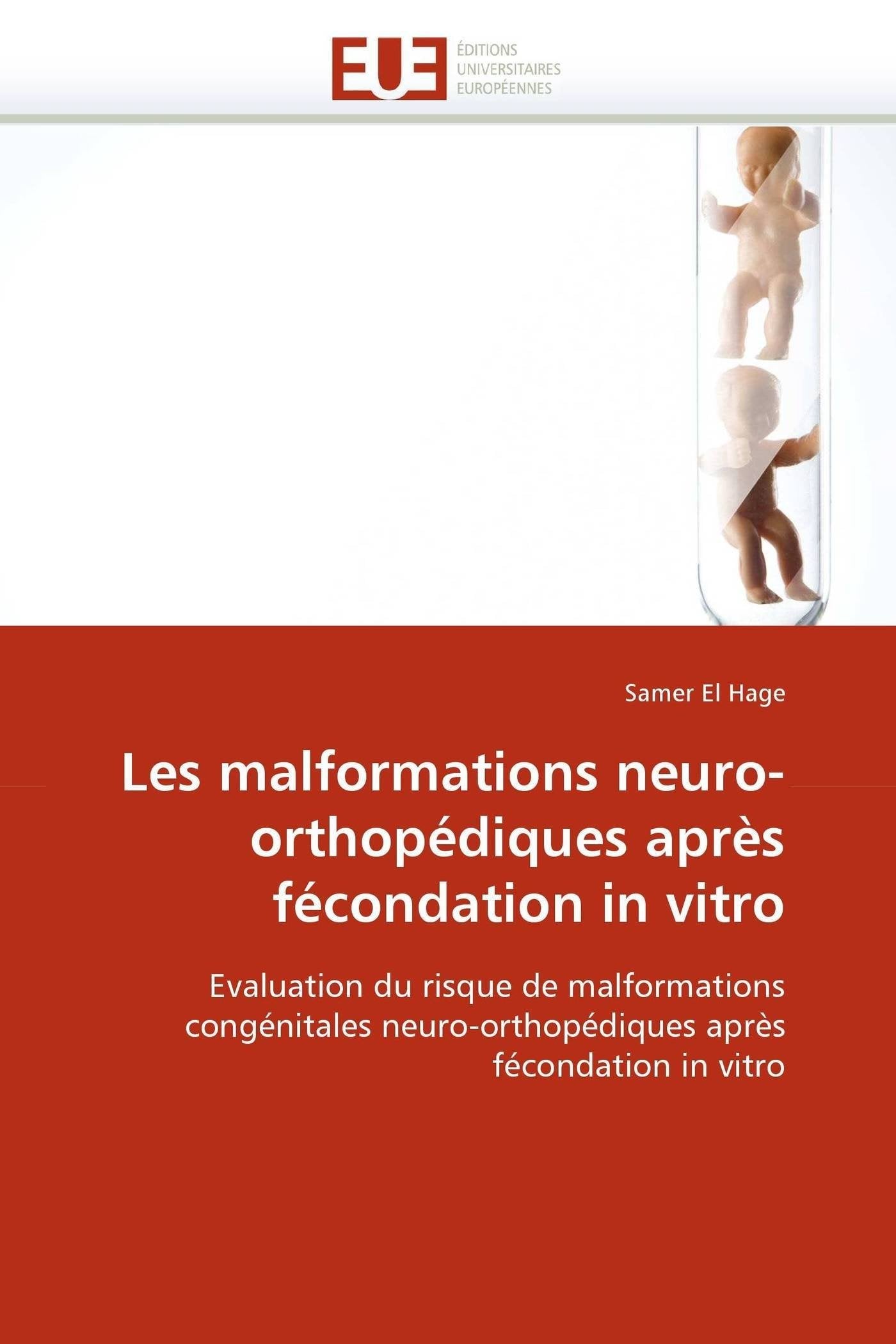 Les malformations neuro-orthopédiques après fécondation in vitro: Evaluation du risque de malformations congénitales neuro-orthopédiques après fécondation in vitro book