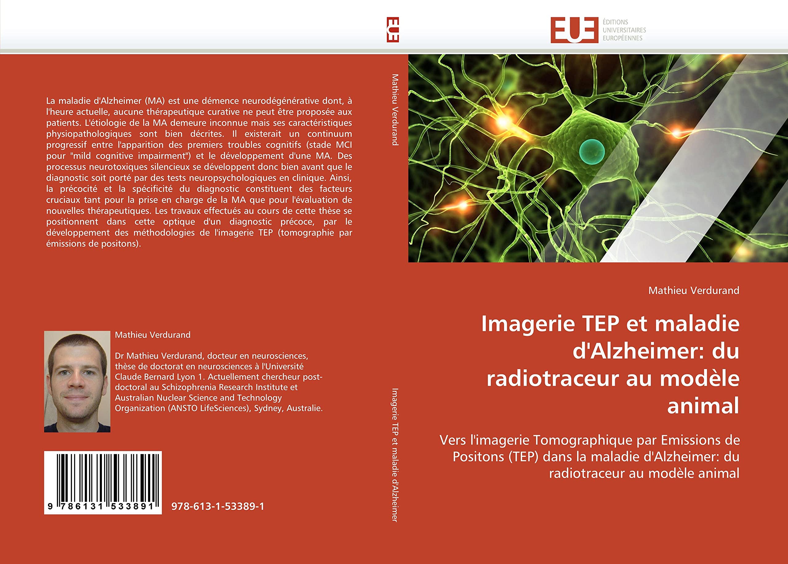 Imagerie TEP et maladie d'Alzheimer: du radiotraceur au modèle animal: Vers l'imagerie Tomographique par Emissions de Positons (TEP) dans la maladie d'Alzheimer: du radiotraceur au modèle animal book