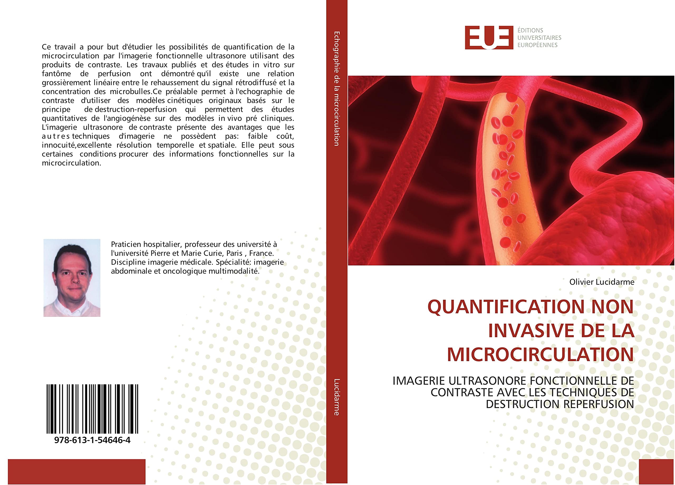 QUANTIFICATION NON INVASIVE DE LA MICROCIRCULATION: IMAGERIE ULTRASONORE FONCTIONNELLE DE CONTRASTE AVEC LES TECHNIQUES DE DESTRUCTION REPERFUSION book