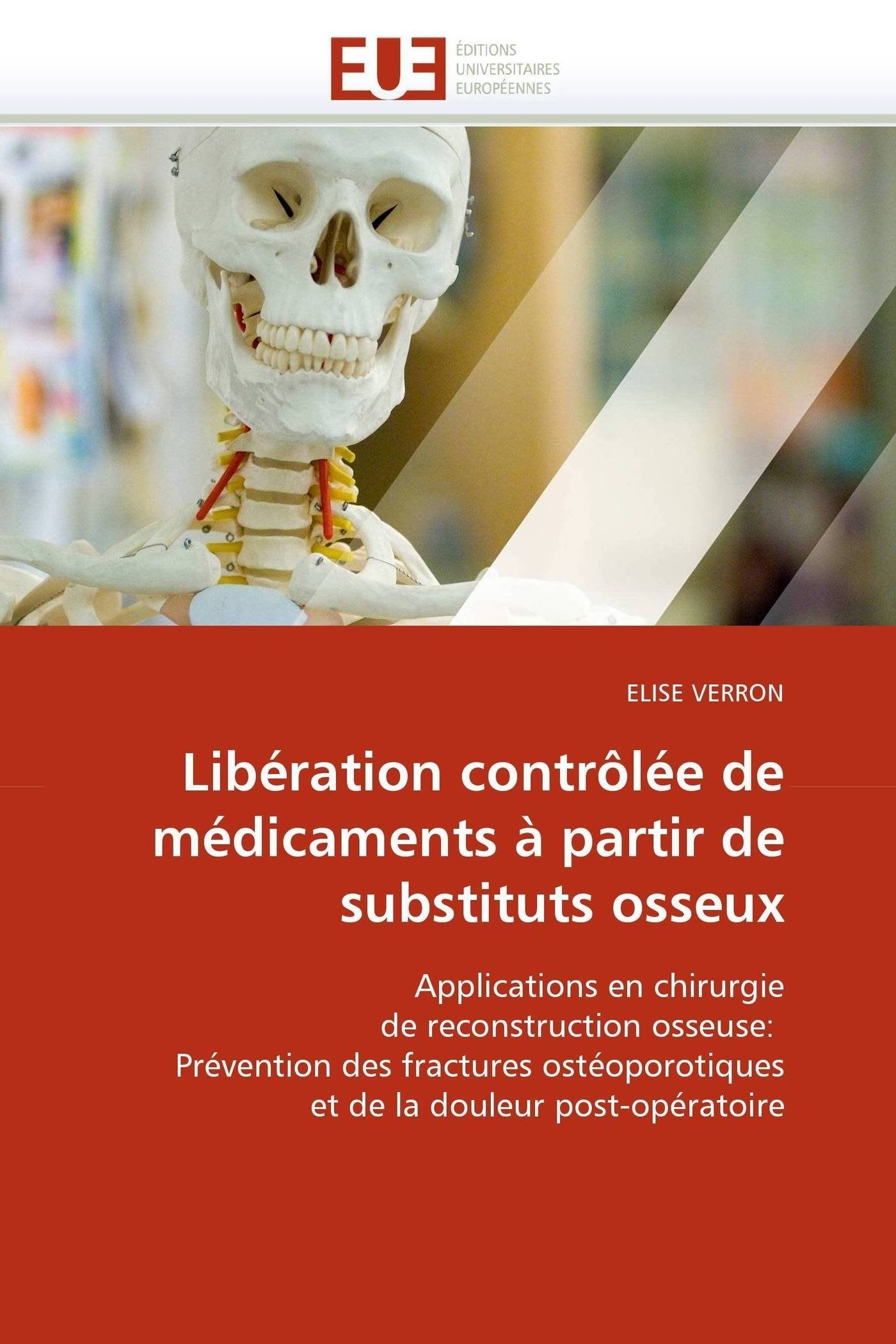 Libération contrôlée de médicaments à partir de substituts osseux: Applications en chirurgie de reconstruction osseuse: Prévention des fractures ostéoporotiques et de la douleur post-opératoire book