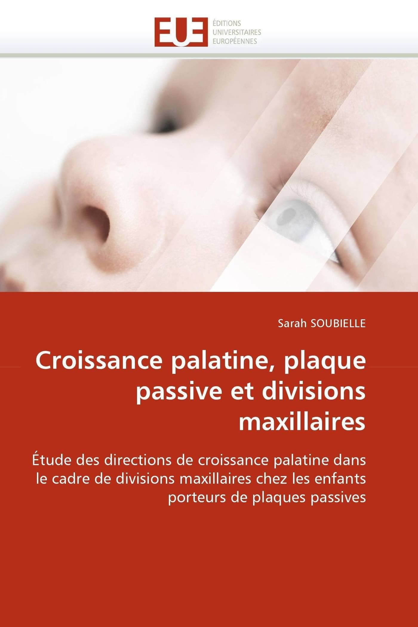 Croissance palatine, plaque passive et divisions maxillaires: Étude des directions de croissance palatine dans le cadre de divisions maxillaires chez les enfants porteurs de plaques passives book