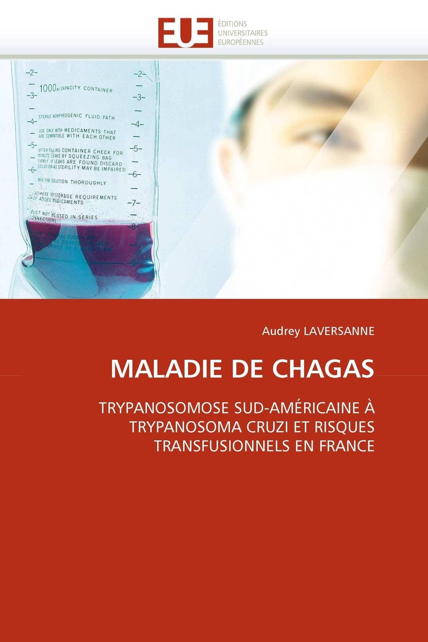 MALADIE DE CHAGAS: TRYPANOSOMOSE SUD-AMÉRICAINE À TRYPANOSOMA CRUZI ET RISQUES TRANSFUSIONNELS EN FRANCE book