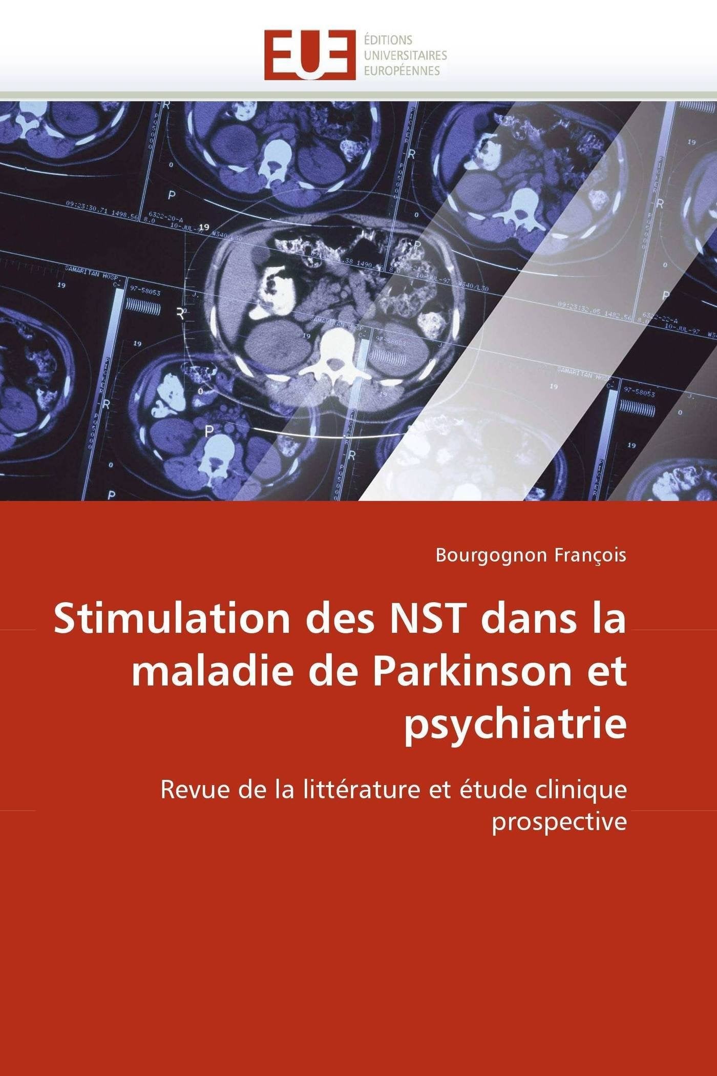 Stimulation des NST dans la maladie de Parkinson et psychiatrie: Revue de la littérature et étude clinique prospective book