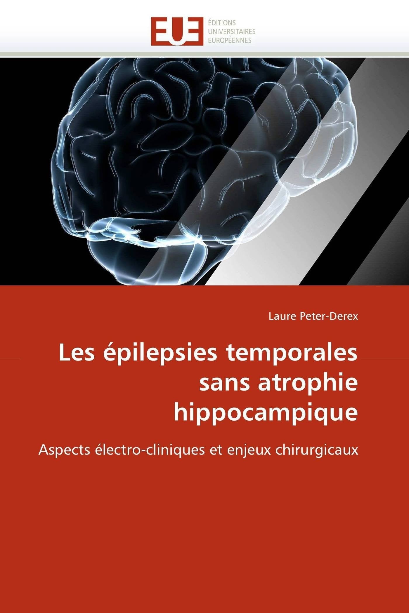 Les épilepsies temporales sans atrophie hippocampique: Aspects électro-cliniques et enjeux chirurgicaux book