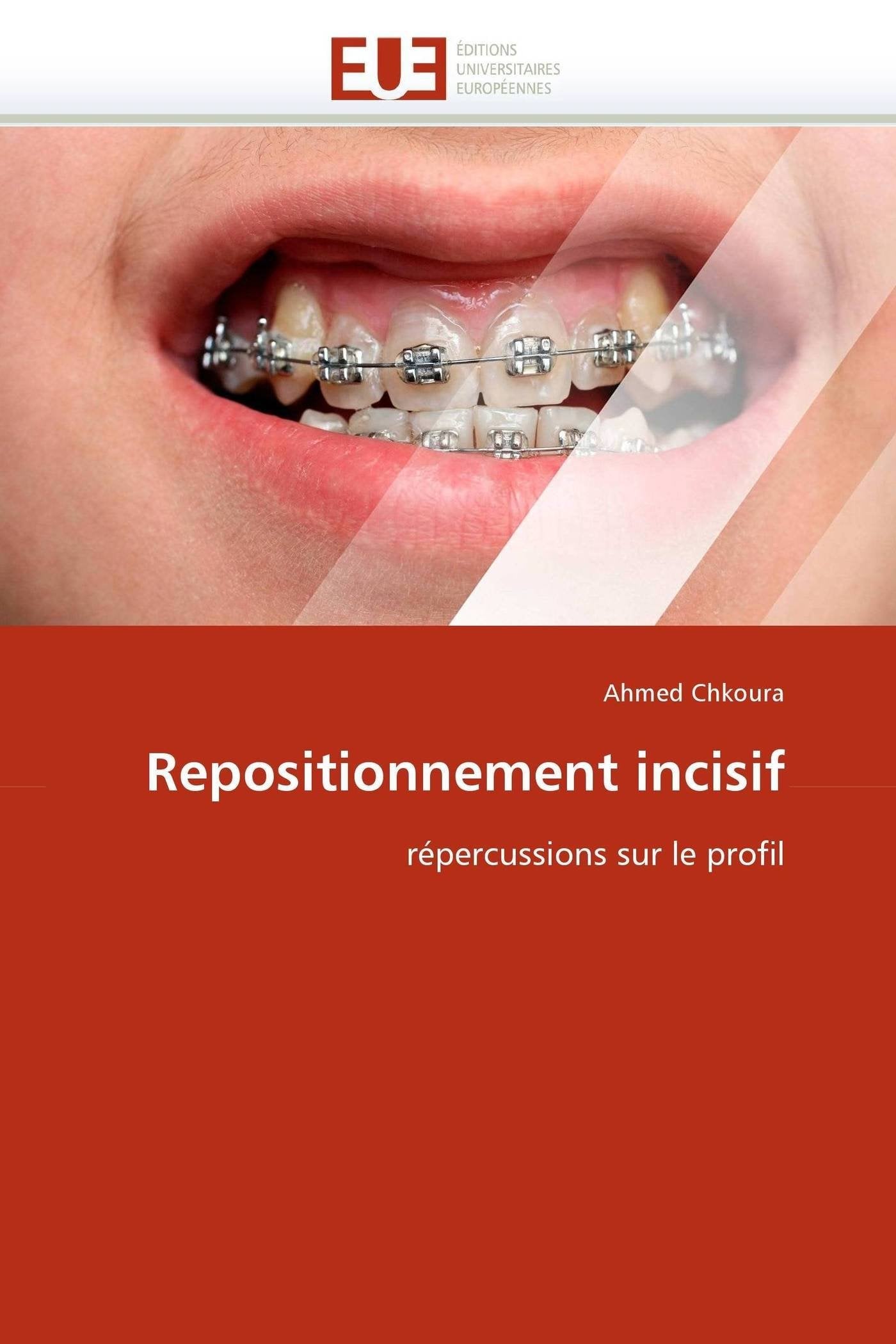 Repositionnement incisif: répercussions sur le profil book