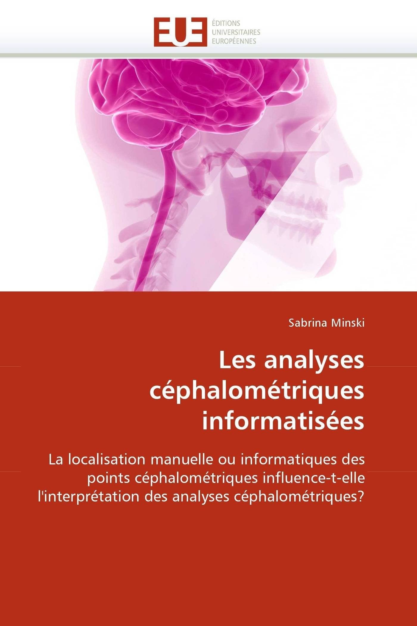 Les analyses céphalométriques informatisées: La localisation manuelle ou informatiques des points céphalométriques influence-t-elle l'interprétation des analyses céphalométriques? book