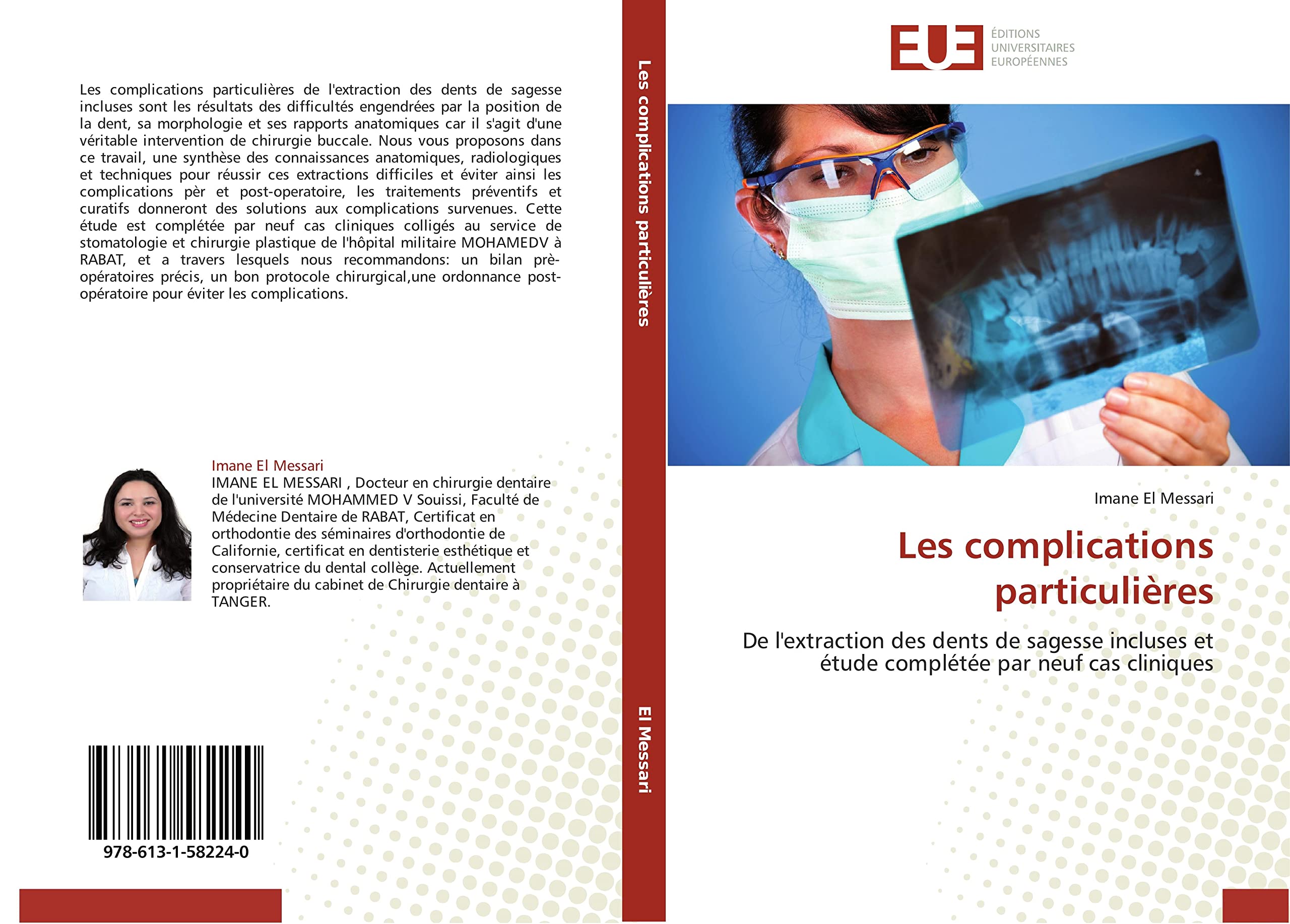 Les complications particulières: De l'extraction des dents de sagesse incluses et étude complétée par neuf cas cliniques book