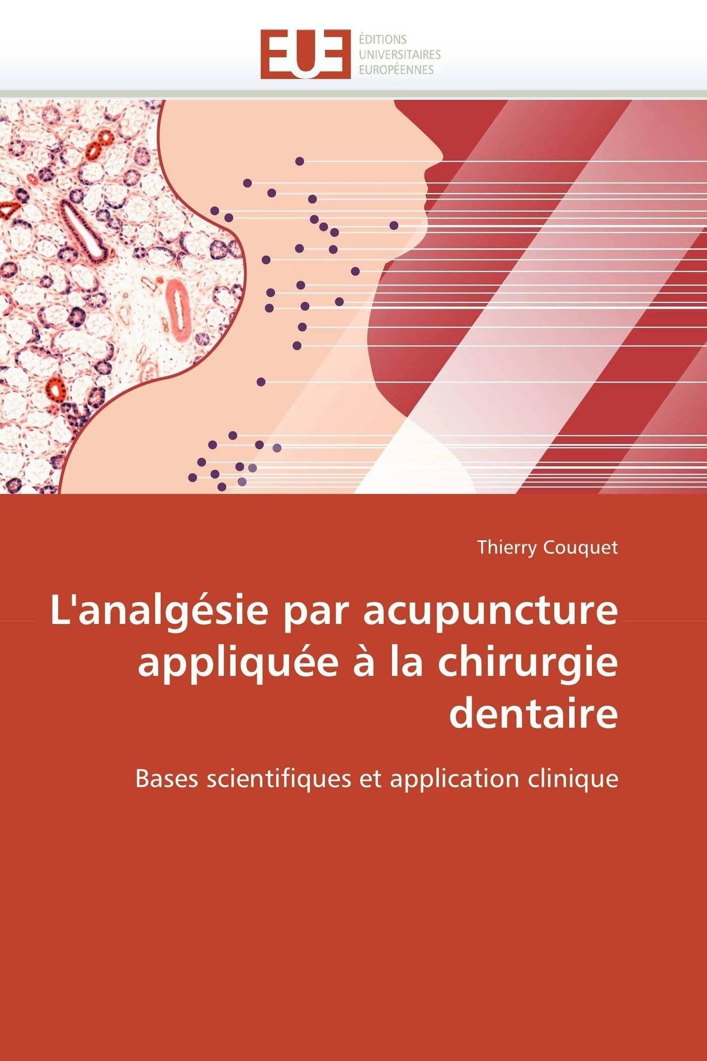 L'analgésie par acupuncture appliquée à la chirurgie dentaire: Bases scientifiques et application clinique book