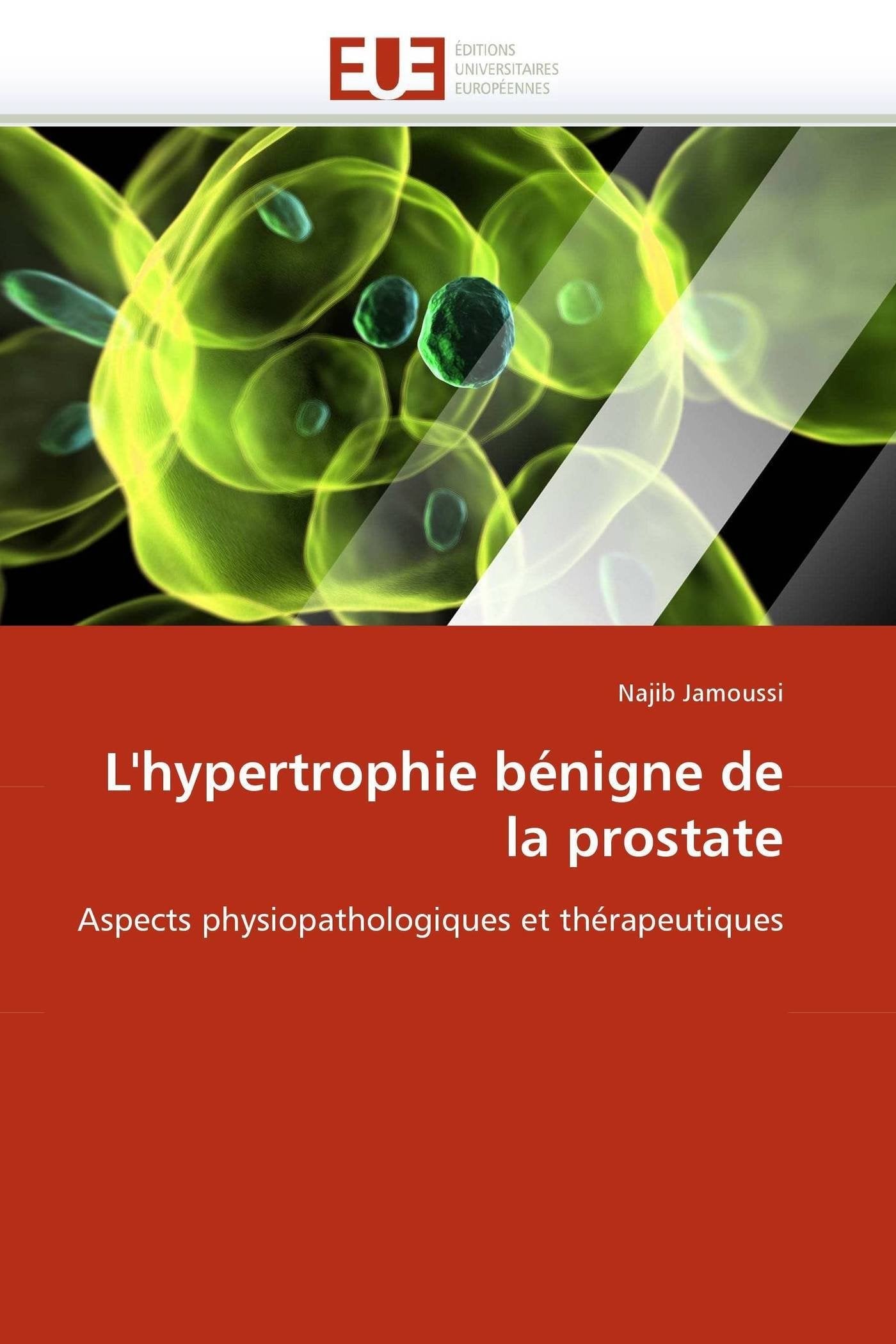 L'hypertrophie bénigne de la prostate: Aspects physiopathologiques et thérapeutiques book