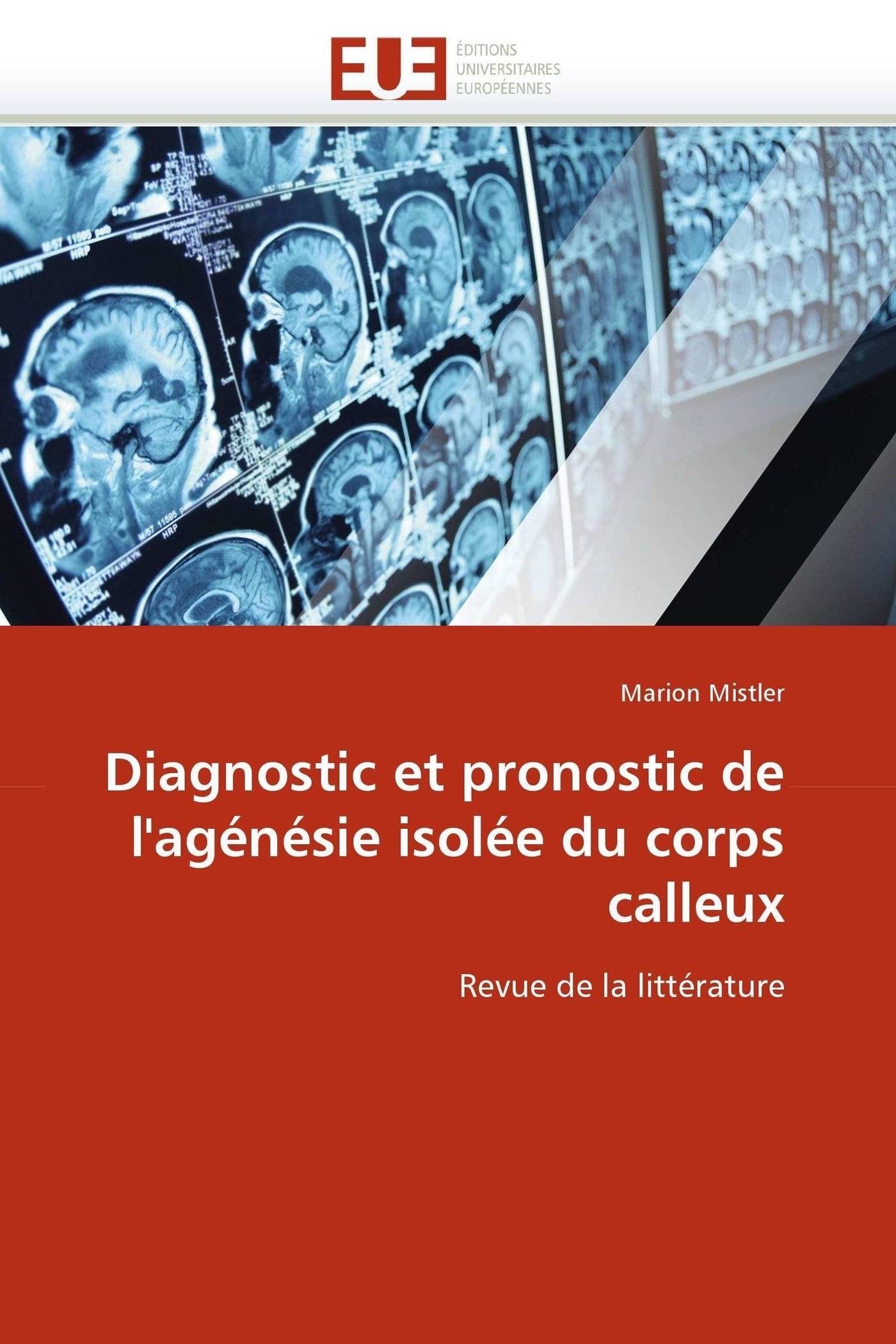 Diagnostic et pronostic de l'agénésie isolée du corps calleux: Revue de la littérature book
