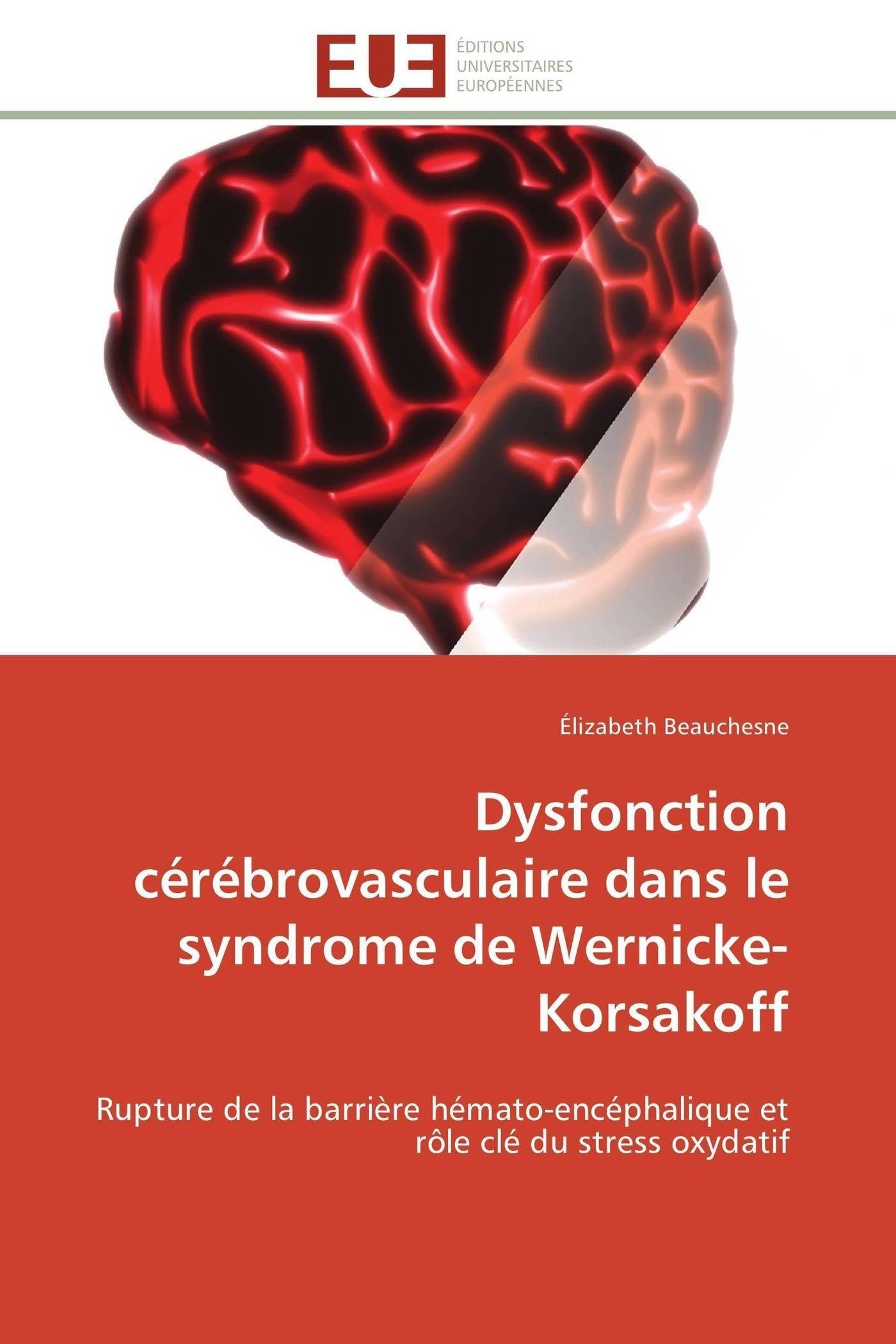 Dysfonction cérébrovasculaire dans le syndrome de Wernicke-Korsakoff: Rupture de la barrière hémato-encéphalique et rôle clé du stress oxydatif (Omn.Univ.Europ.) Medicine