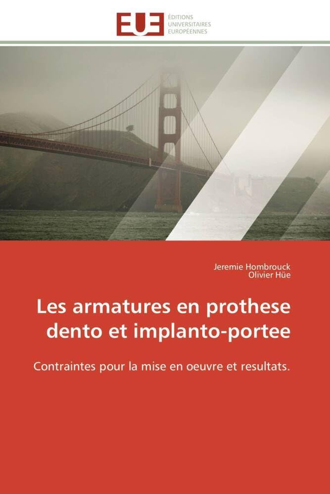 Les armatures en prothese dento et implanto-portee: Contraintes pour la mise en oeuvre et resultats. book